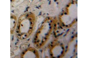 Used in DAB staining on fromalin fixed paraffin-embedded Kidney tissue (THSD7A anticorps  (AA 42-242))
