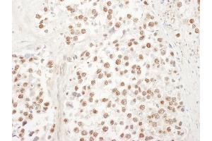 Immunohistochemistry (IHC) image for anti-Ubiquitin-Like 7 (Bone Marrow Stromal Cell-Derived) (UBL7) (AA 330-380) antibody (ABIN7454886) (UBL7 anticorps  (AA 330-380))