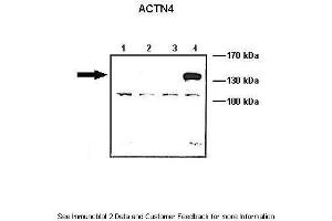 Lanes:   Lane1: 10 ug ACTN1-GFP transfected COS-7 lysate Lane2: 10 ug ACTN2-GFP transfected COS-7 lysate Lane3: 10 ug ACTN3-GFP transfected COS-7 lysate Lane4: 10 ug ACTN4-GFP transfected COS-7 lysate  Primary Antibody Dilution:   1: 1000  Secondary Antibody:   Anti-rabbit HRP  Secondary Antibody Dilution:   1:5000  Gene Name:   ACTN4  Submitted by:   Johannes W.