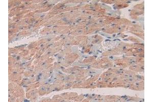 Detection of SDF1 in Mouse Heart Tissue using Polyclonal Antibody to Stromal Cell Derived Factor 1 (SDF1)