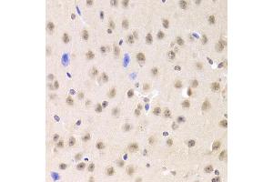 Immunohistochemistry of paraffin-embedded mouse brain using PRPF3 Antibody (ABIN5973192) at dilution of 1/100 (40x lens). (PRPF3 anticorps)
