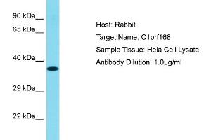 Host: Rabbit Target Name: C1ORF168 Sample Tissue: Human Hela Whole cell Antibody Dilution: 1ug/ml