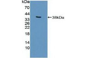 Western blot analysis of recombinant Human EP300. (p300 anticorps  (AA 1351-1601))