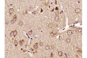 Paraformaldehyde-fixed, paraffin embedded rat brain, Antigen retrieval by boiling in sodium citrate buffer (pH6) for 15min, Block endogenous peroxidase by 3% hydrogen peroxide for 30 minutes,  Blocking buffer (normal goat serum) at 37°C for 20min, Antibody incubation with Pyk2 (Tyr402) Polyclonal Antibody (bs-3400R) at 1:400 overnight at 4°C, followed by a conjugated secondary and DAB staining.