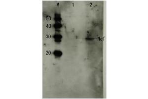 Western Blotting (WB) image for anti-HIV-1 Nef (full length) antibody (ABIN2452025) (HIV-1 Nef (full length) anticorps)