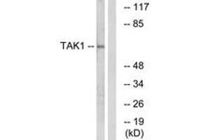 Western blot analysis of extracts from HepG2 cells, using TAK1 (Ab-184) Antibody. (TR4 anticorps  (AA 161-210))
