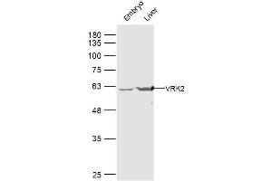 Lane 1: mouse embryo lysates Lane 2: mouse liver lysates probed with VRK2 Polyclonal Antibody, Unconjugated  at 1:300 dilution and 4˚C overnight incubation. (VRK2 anticorps  (AA 151-250))