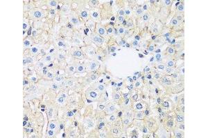 Immunohistochemistry of paraffin-embedded Rat liver using ARL4A Polyclonal Antibody at dilution of 1:100 (40x lens).