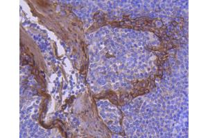Paraformaldehyde-fixed, paraffin embedded human tonsil tissue, Antigen retrieval by boiling in sodium citrate buffer (pH6) for 15min, Block endogenous peroxidase by 3% hydrogen peroxide for 30 minutes, Blocking buffer (normal serum) at 37°C for 20min, Antibody incubation with Cytokeratin 2e (2F7) Monoclonal Antibody  at 1:50 overnight at 4°C, followed by a conjugated secondary and DAB staining.