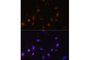 Immunofluorescence analysis of U-2 OS cells using SNW1 antibody (ABIN7270386) at dilution of 1:100.