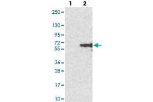 Western blot analysis of Lane 1: Negative control (vector only transfected HEK293T lysate). (CLN5 anticorps)