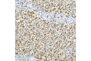 Immunohistochemistry of paraffin-embedded rat ovary using GC1q R/C1QBP antibody (ABIN7266473) at dilution of 1:25 (40x lens).