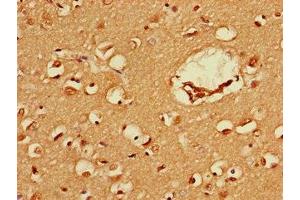 Immunohistochemistry of paraffin-embedded human brain tissue using ABIN7152586 at dilution of 1:100 (FEZ1 anticorps  (AA 12-200))