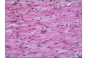 Human Intestine, Muscularis Propria: Formalin-Fixed, Paraffin-Embedded (FFPE) (PPP3CA anticorps  (N-Term))