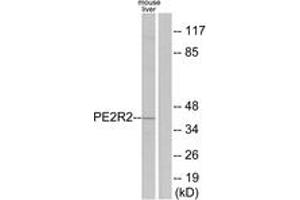 Western blot analysis of extracts from mouse liver cells, using PE2R2 Antibody. (PTGER2 anticorps  (AA 261-310))