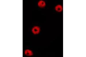 ABIN6275446 staining HepG2 by IF/ICC. (GFR anticorps  (C-Term))
