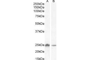 (ABIN185328), (2 μg/mL) staining of Human Liver (A) and (1 μg/mL) Ovary (B) lysate (35 μg protein in RIPA buffer) Detected by chemiluminescence.