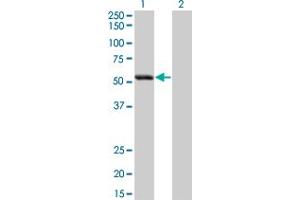 Western Blot analysis of SIGLEC6 expression in transfected 293T cell line by SIGLEC6 monoclonal antibody (M02), clone 2G6. (SIGLEC6 anticorps  (AA 371-453))