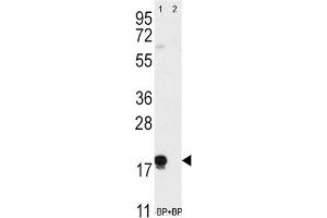 Western Blotting (WB) image for anti-CD90 (THY1) antibody (ABIN3001433) (CD90 anticorps)