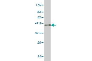 Western Blot detection against Immunogen (35. (MYO3A anticorps  (AA 1400-1490))