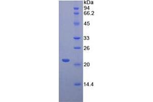 SDS-PAGE analysis of Mouse CD8b Protein.