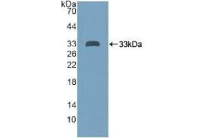 Detection of Recombinant PTPRH, Human using Polyclonal Antibody to Protein Tyrosine Phosphatase Receptor Type H (PTPRH)