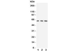 Western blot testing of SLC22A3 antibody and Lane 1:  rat liver;  2: human 293T;  3: (h) A549 cell lysate.
