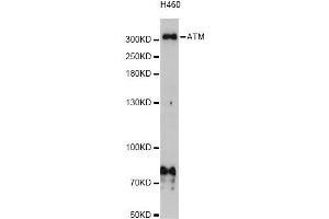 Western blot analysis of extracts of H460 cells, using ATM Antibody (ABIN5973499) at 1/1000 dilution. (ATM anticorps)