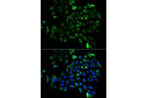 Immunofluorescence analysis of A549 cells using EEF1B2 antibody (ABIN5973953). (EEF1B2 anticorps)