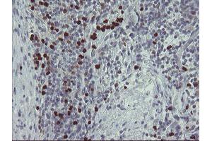 Image no. 2 for anti-Peptidyl Arginine Deiminase, Type IV (PADI4) (AA 299-588) antibody (ABIN1491357)