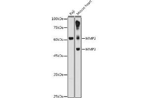 Western blot analysis of extracts of various cell lines, using MMP3 antibody (ABIN3021708, ABIN3021709, ABIN3021710 and ABIN6215578) at 1:1000 dilution.
