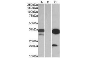 HEK293 lysate (10 µg protein in RIPA buffer) over expressing Human DAPP1 with DYKDDDDK tag probed with this Antibody (0. (DAPP1 anticorps  (Internal Region))