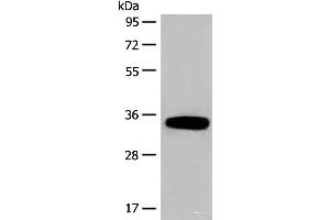 Western blot analysis of Human fetal liver tissue lysate using DHRS1 Polyclonal Antibody at dilution of 1:400