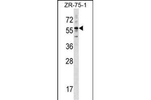 KRT3 Antibody (Center) (ABIN1538406 and ABIN2848455) western blot analysis in ZR-75-1 cell line lysates (35 μg/lane). (Keratin 3 anticorps  (AA 414-441))