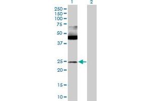 Western Blot analysis of MAX expression in transfected 293T cell line by MAX MaxPab polyclonal antibody. (MAX anticorps  (AA 1-151))