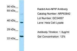 Western Blotting (WB) image for anti-Nuclear Pore Complex Interacting Protein Family, Member A1 (NPIPA1) (Middle Region) antibody (ABIN2789641) (NPIPA1 anticorps  (Middle Region))