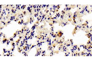 Detection of STAT6 in Rat Lung Tissue using Polyclonal Antibody to Signal Transducer And Activator Of Transcription 6 (STAT6)