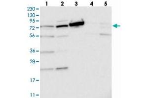 Western blot analysis of Lane 1: RT-4, Lane 2: U-251 MG, Lane 3: Human Plasma, Lane 4: Liver, Lane 5: Tonsil with TOP1MT polyclonal antibody . (TOP1MT anticorps)
