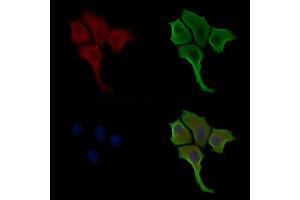 Phospho-MLKL (Thr357) Antibody staining HepG2 cells(serum starvation treatment) by IF/ICC.