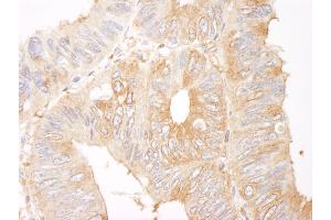 Immunohistochemistry (IHC) image for anti-Coronin, Actin Binding Protein, 1B (CORO1B) (AA 450-489) antibody (ABIN7454736)