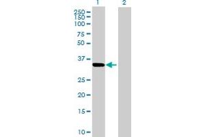 Western Blot analysis of CBR3 expression in transfected 293T cell line by CBR3 MaxPab polyclonal antibody.