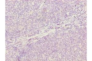 Immunohistochemistry of paraffin-embedded human tonsil tissue using ABIN7142334 at dilution of 1:100 (OXSM anticorps  (AA 78-345))