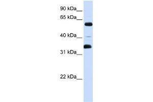 WB Suggested Anti-ZKSCAN1 Antibody Titration:  0. (ZKSCAN1 anticorps  (Middle Region))
