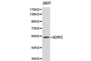 Western Blotting (WB) image for anti-Activin Receptor Type 1C (ACVR1C) antibody (ABIN1870797) (ACVR1C/ALK7 anticorps)