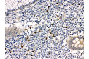 Anti- MMP8 Picoband antibody,IHC(P) IHC(P): Human Appendicitis Tissue