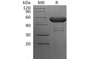 Western Blotting (WB) image for Cytotoxic T-Lymphocyte-Associated Protein 4 (CTLA4) protein (Fc Tag) (ABIN7320970)