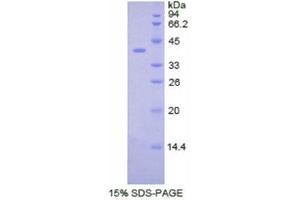 SDS-PAGE (SDS) image for Colony Stimulating Factor 2 Receptor, Beta (CSF2RB) (AA 133-233) protein (His tag,GST tag) (ABIN1878174) (CD131 Protein (AA 133-233) (His tag,GST tag))