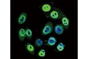 anti-SMAD Family Member 4 (SMAD4) (pThr277) antibody