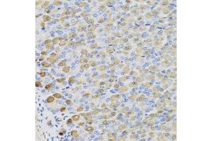 Immunohistochemistry of paraffin-embedded mouse stomach using LDHB antibody at dilution of 1:100 (x40 lens). (LDHB anticorps)