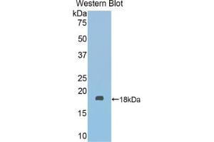 Western blot analysis of the recombinant protein. (Fascin 2 anticorps  (AA 308-442))